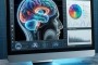 تشخیص زودهنگام بیماری آلزایمر با استفاده از MRI و Deep Learning: مروری بر شواهد، روشها و چالشهای انتقال به بالین
